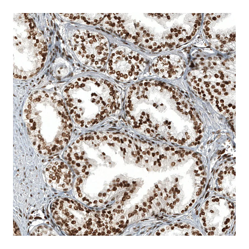 Atlas Antibodies Anti-ZNF827 Antibody