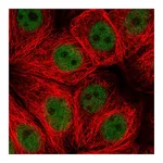 Atlas Antibodies Anti-ZNF821 Antibody