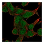 Atlas Antibodies Anti-ZNF829 Antibody