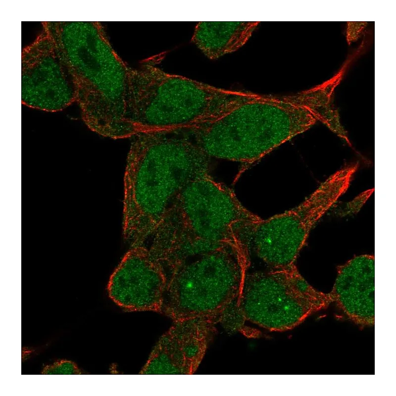 Atlas Antibodies Anti-ZNF829 Antibody