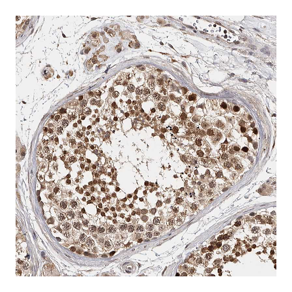 Atlas Antibodies Anti-ZNF83 Antibody