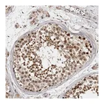 Atlas Antibodies Anti-ZNF83 Antibody