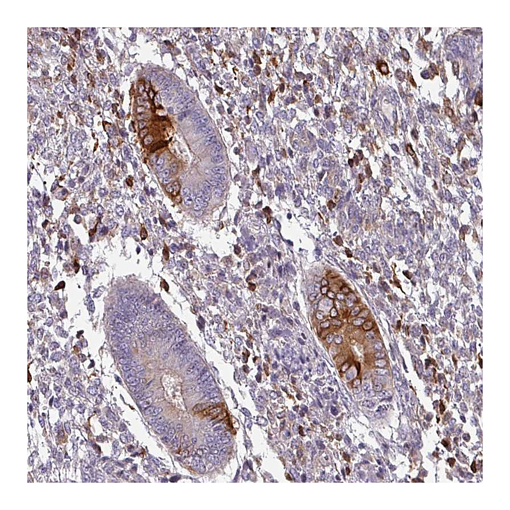 Atlas Antibodies Anti-ZNF835 Antibody
