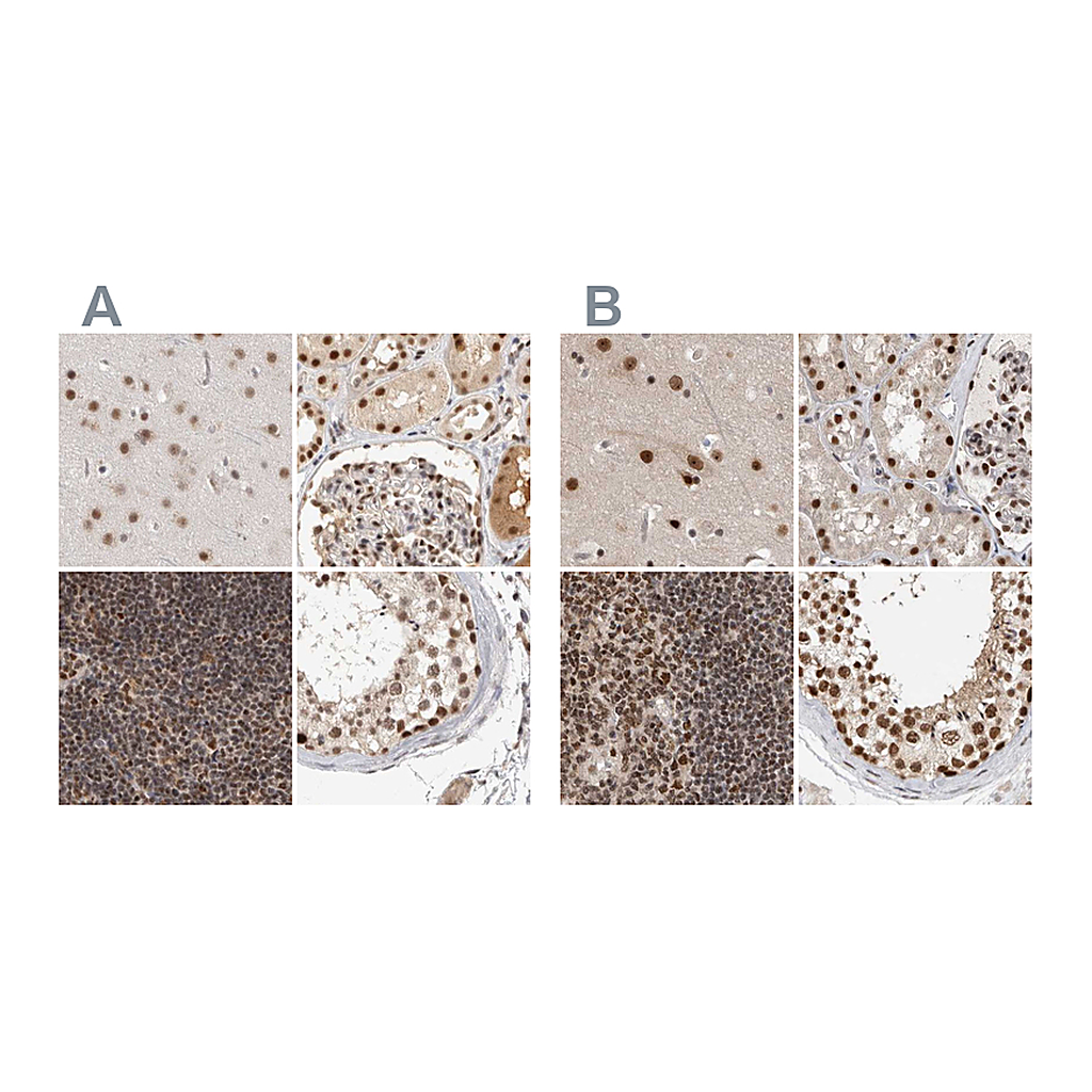 Atlas Antibodies Anti-ZNF830 Antibody