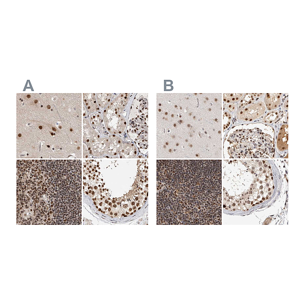 Atlas Antibodies Anti-ZNF830 Antibody