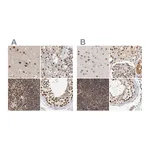 Atlas Antibodies Anti-ZNF830 Antibody