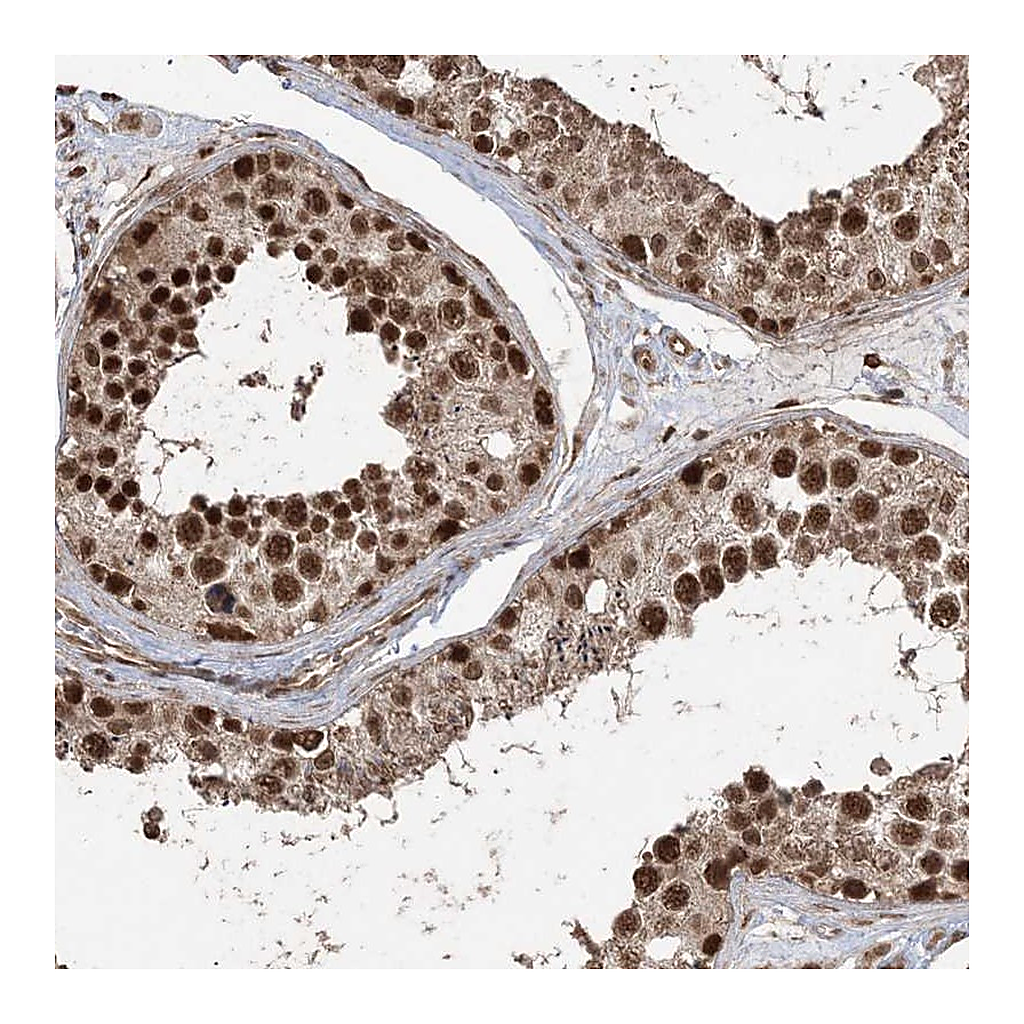 Atlas Antibodies Anti-ZNF839 Antibody