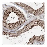 Atlas Antibodies Anti-ZNF839 Antibody