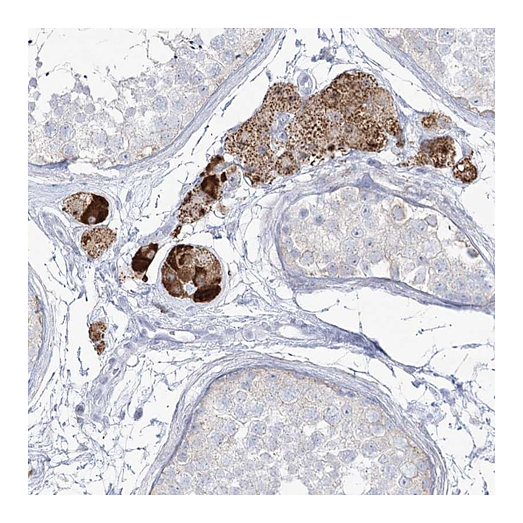 Atlas Antibodies Anti-ZNF843 Antibody