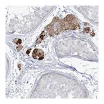 Atlas Antibodies Anti-ZNF843 Antibody