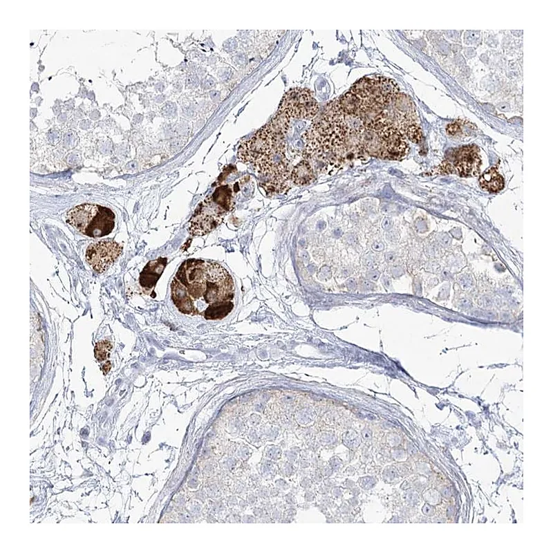 Atlas Antibodies Anti-ZNF843 Antibody