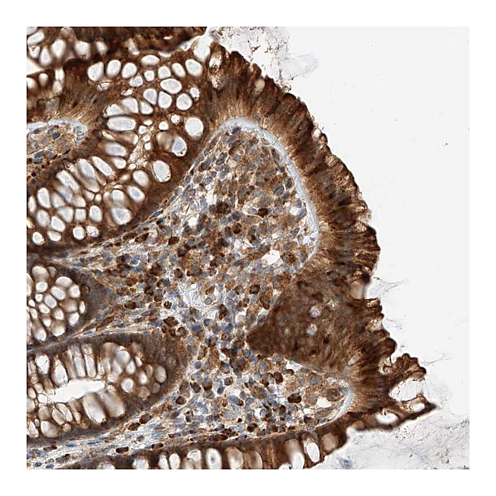 Atlas Antibodies Anti-ZNF84 Antibody