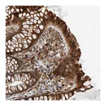 Atlas Antibodies Anti-ZNF84 Antibody