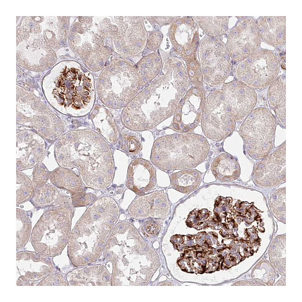 Atlas Antibodies Anti-ZNF843 Antibody
