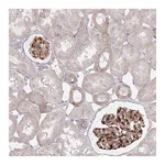 Atlas Antibodies Anti-ZNF843 Antibody