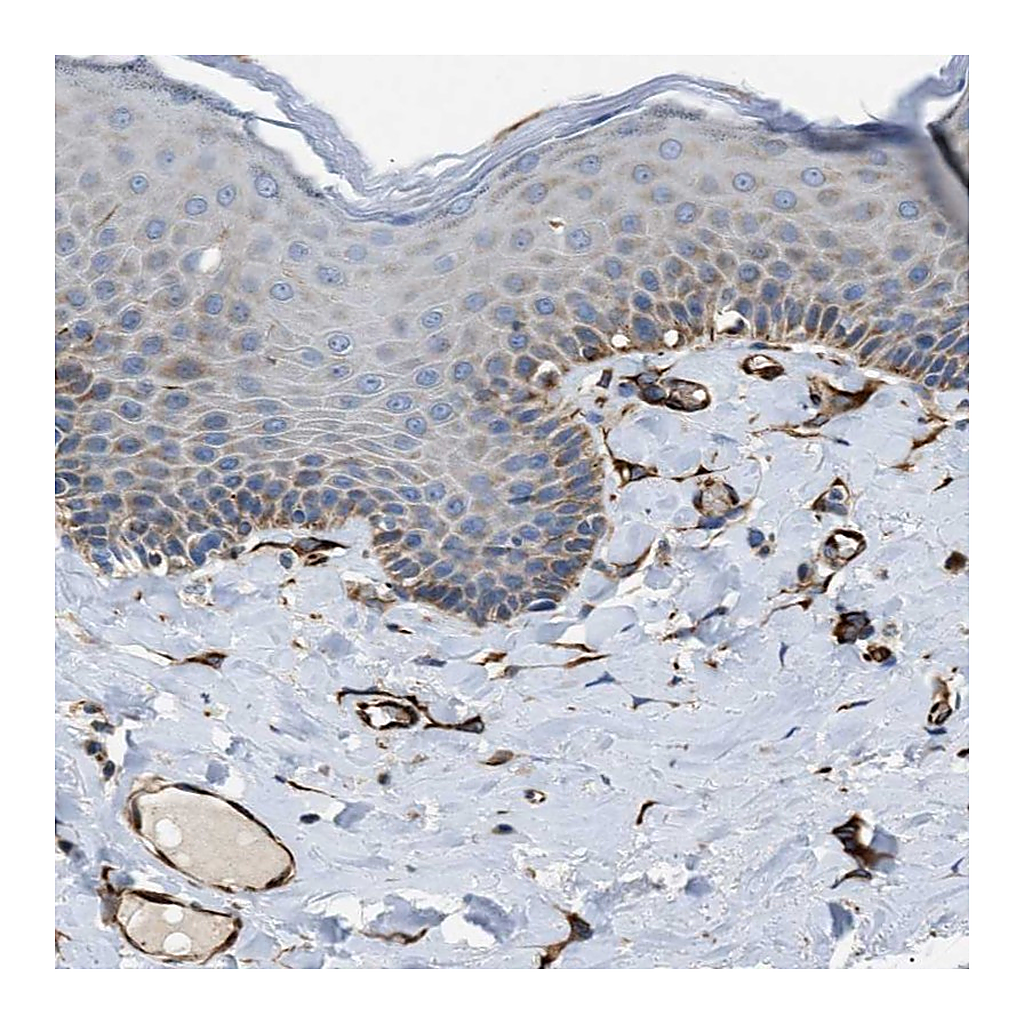 Atlas Antibodies Anti-ZNF831 Antibody