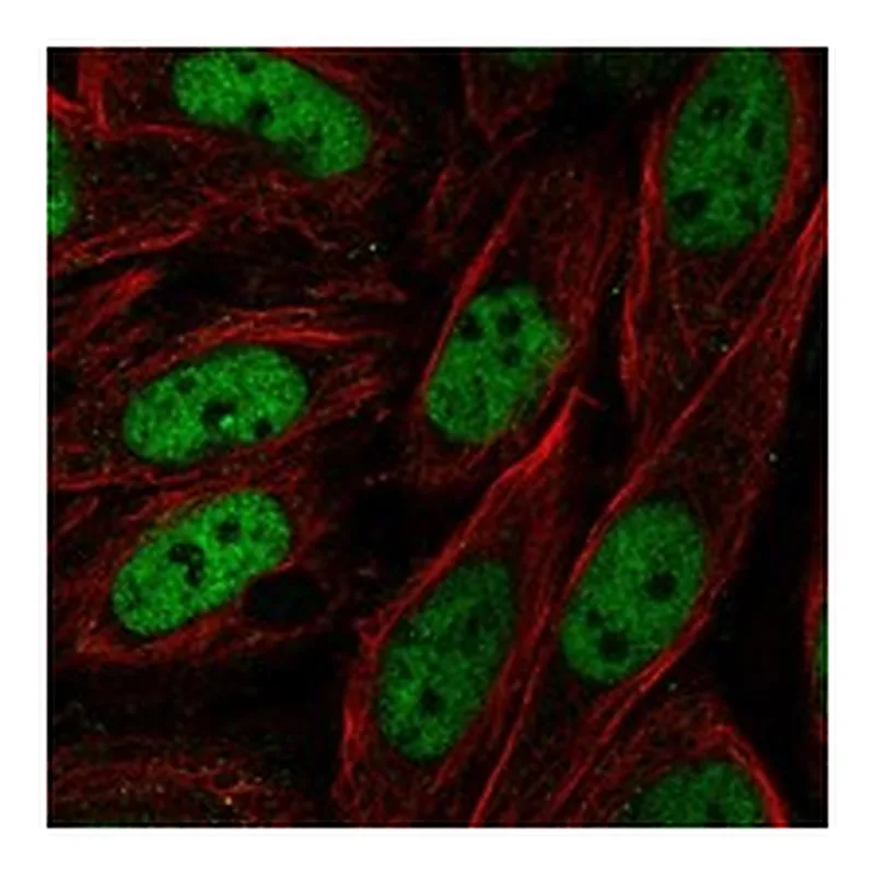 Atlas Antibodies Anti-ZNF843 Antibody