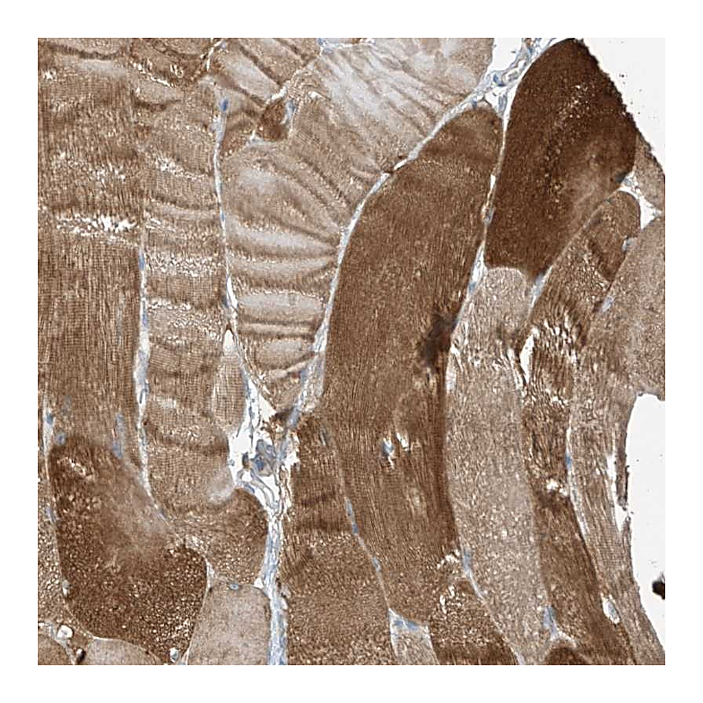Atlas Antibodies Anti-ZNF846 Antibody
