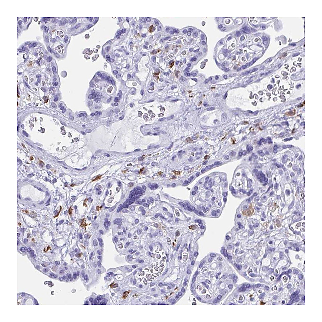 Atlas Antibodies Anti-ZNF850 Antibody