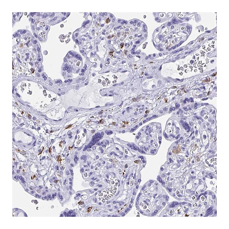 Atlas Antibodies Anti-ZNF850 Antibody