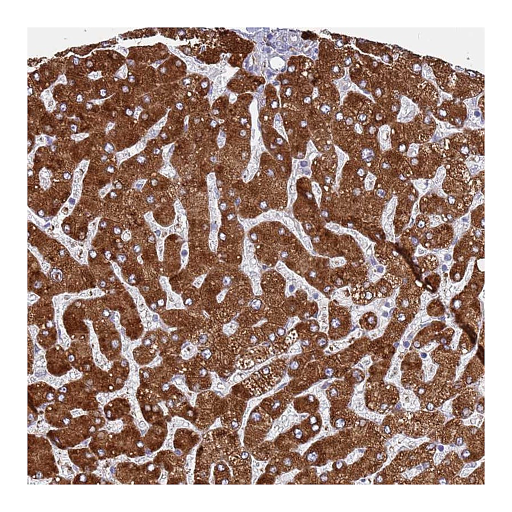 Atlas Antibodies Anti-ZNF844 Antibody