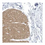 Atlas Antibodies Anti-ZNF846 Antibody