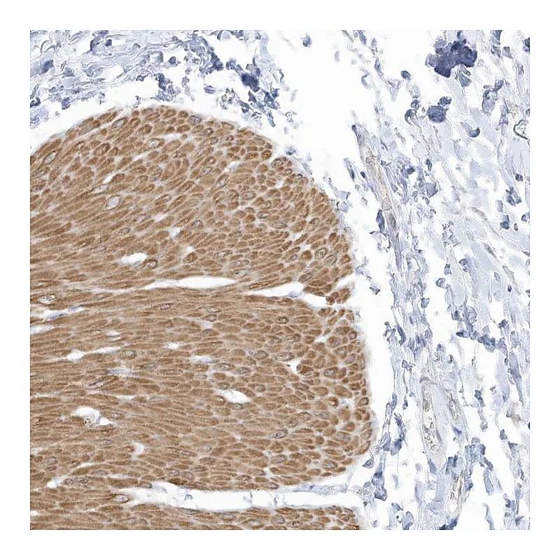 Atlas Antibodies Anti-ZNF846 Antibody