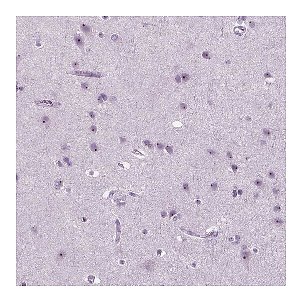 Atlas Antibodies Anti-ZNF853 Antibody