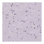 Atlas Antibodies Anti-ZNF853 Antibody