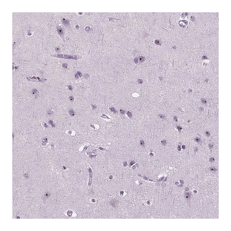 Atlas Antibodies Anti-ZNF853 Antibody