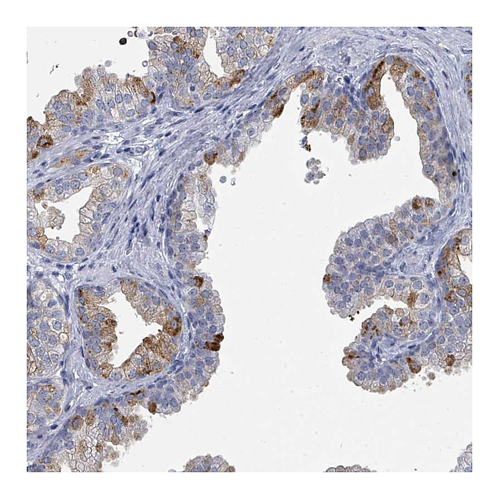 Atlas Antibodies Anti-ZNF852 Antibody