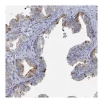 Atlas Antibodies Anti-ZNF852 Antibody