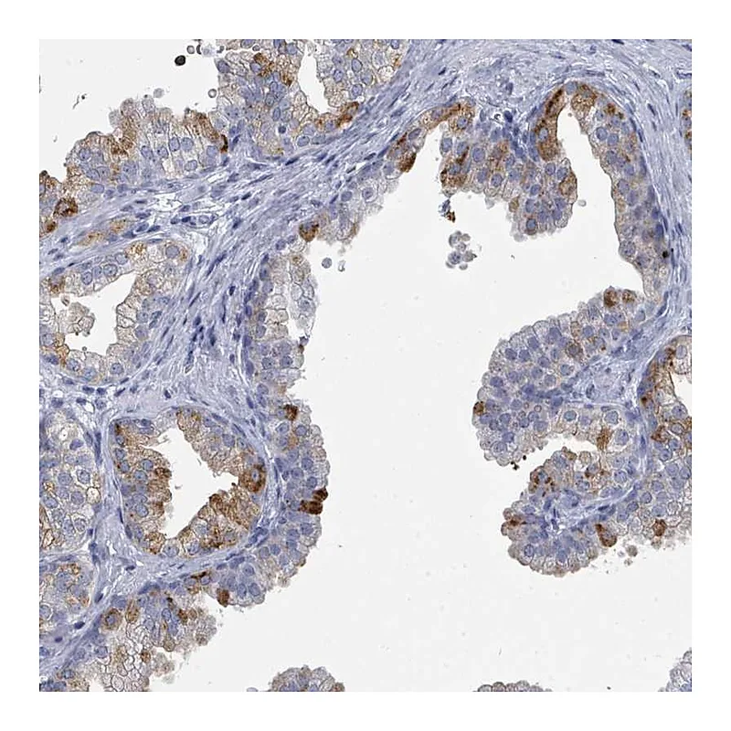 Atlas Antibodies Anti-ZNF852 Antibody