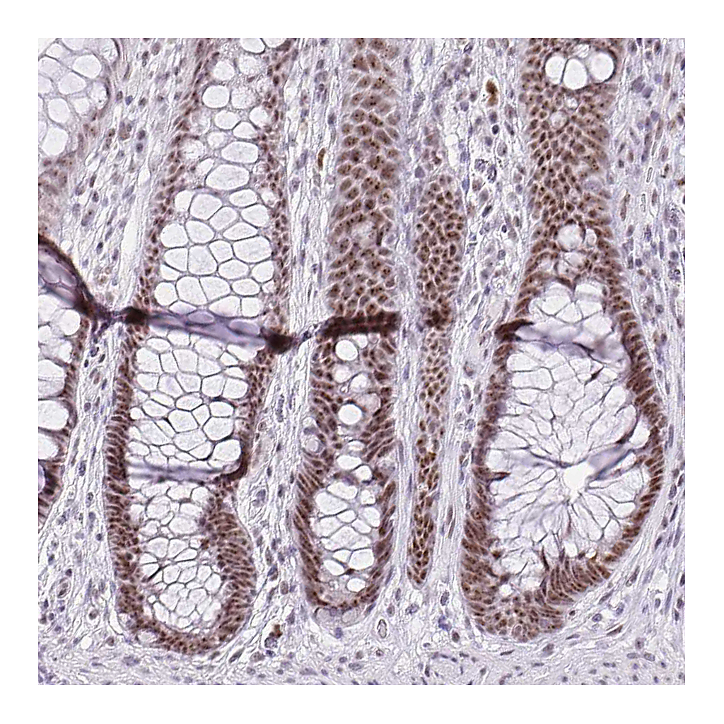 Atlas Antibodies Anti-ZNF860 Antibody