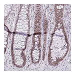 Atlas Antibodies Anti-ZNF860 Antibody