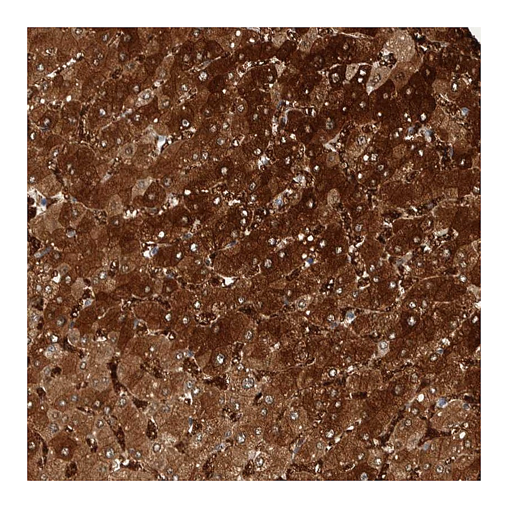 Atlas Antibodies Anti-ZNF862 Antibody