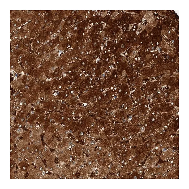 Atlas Antibodies Anti-ZNF862 Antibody