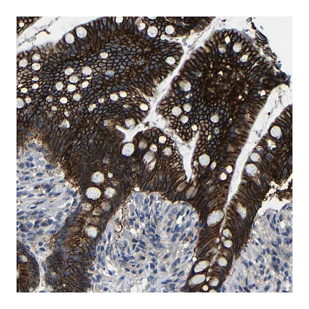 Atlas Antibodies Anti-ZNF90 Antibody