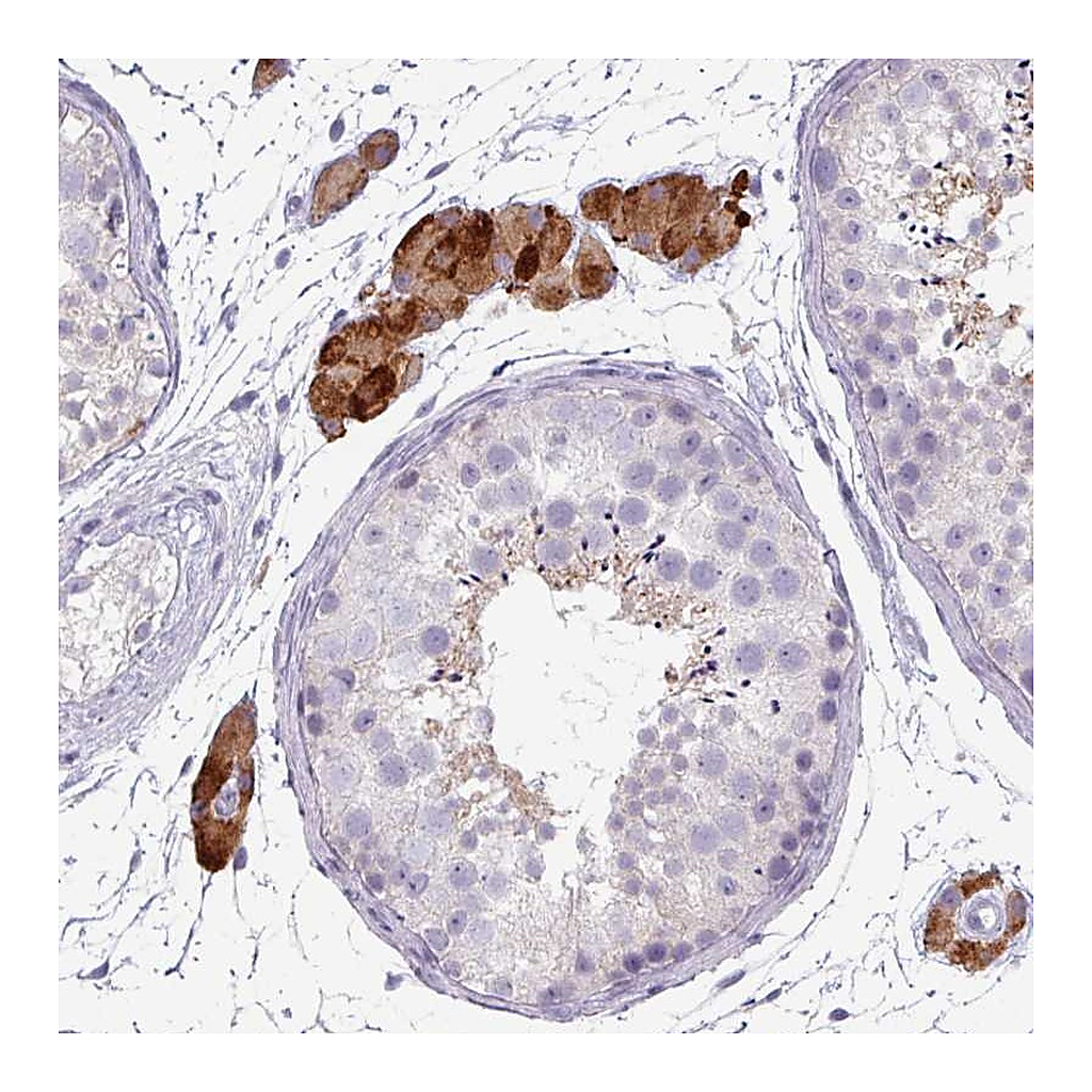 Atlas Antibodies Anti-ZNF878 Antibody