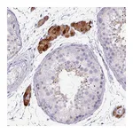 Atlas Antibodies Anti-ZNF878 Antibody