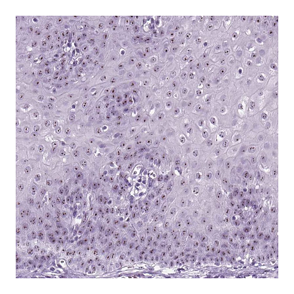 Atlas Antibodies Anti-ZNF865 Antibody