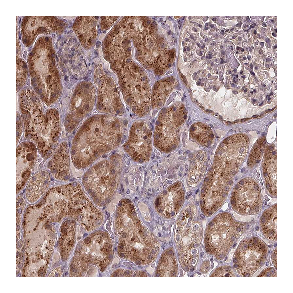 Atlas Antibodies Anti-ZNF879 Antibody