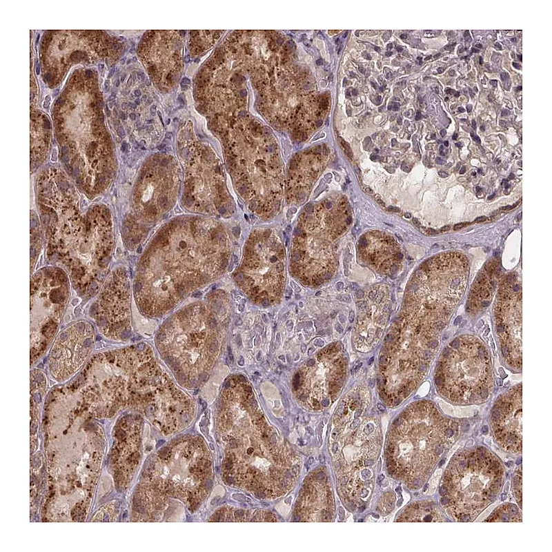 Atlas Antibodies Anti-ZNF879 Antibody