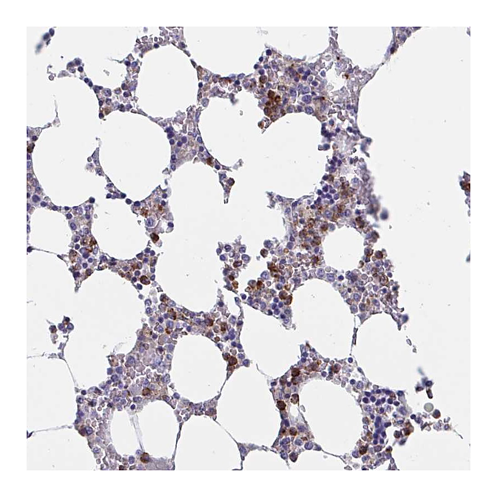 Atlas Antibodies Anti-ZNHIT2 Antibody