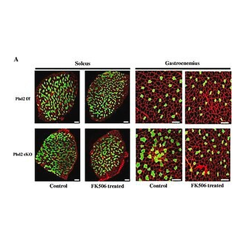 Merck MONOCLONAL ANTI-SKELETAL MYOSIN (SLOW),&