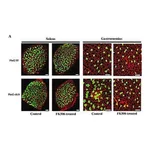 Merck MONOCLONAL ANTI-SKELETAL MYOSIN (SLOW),&