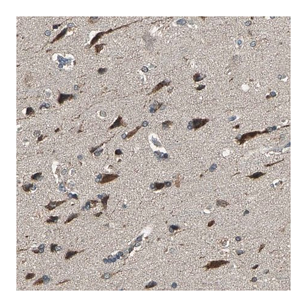 Merck Anti-TRAK1 antibody produced in rabbit