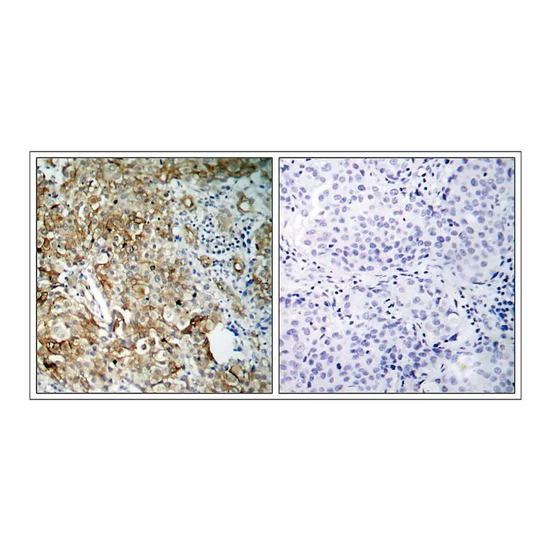 Merck Anti-IGF1R (Ab-1161) antibody produced in rabbit