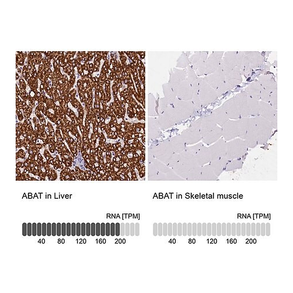Merck Anti-ABAT antibody produced in rabbit