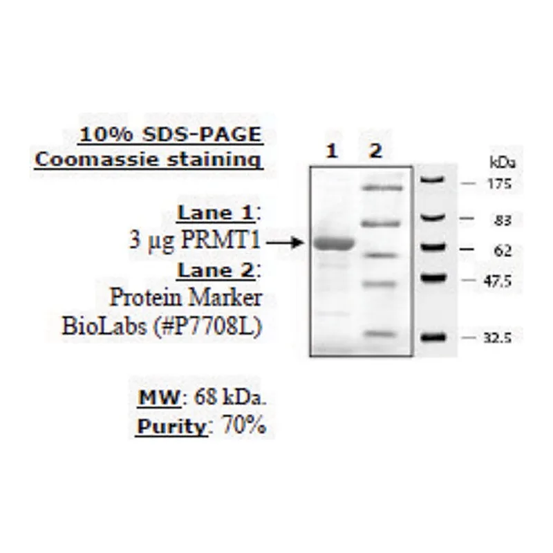 Merck PRMT1 Active human